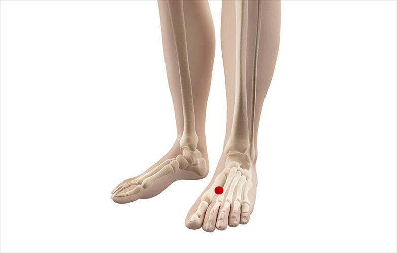 Acupressure for Low Back Pain